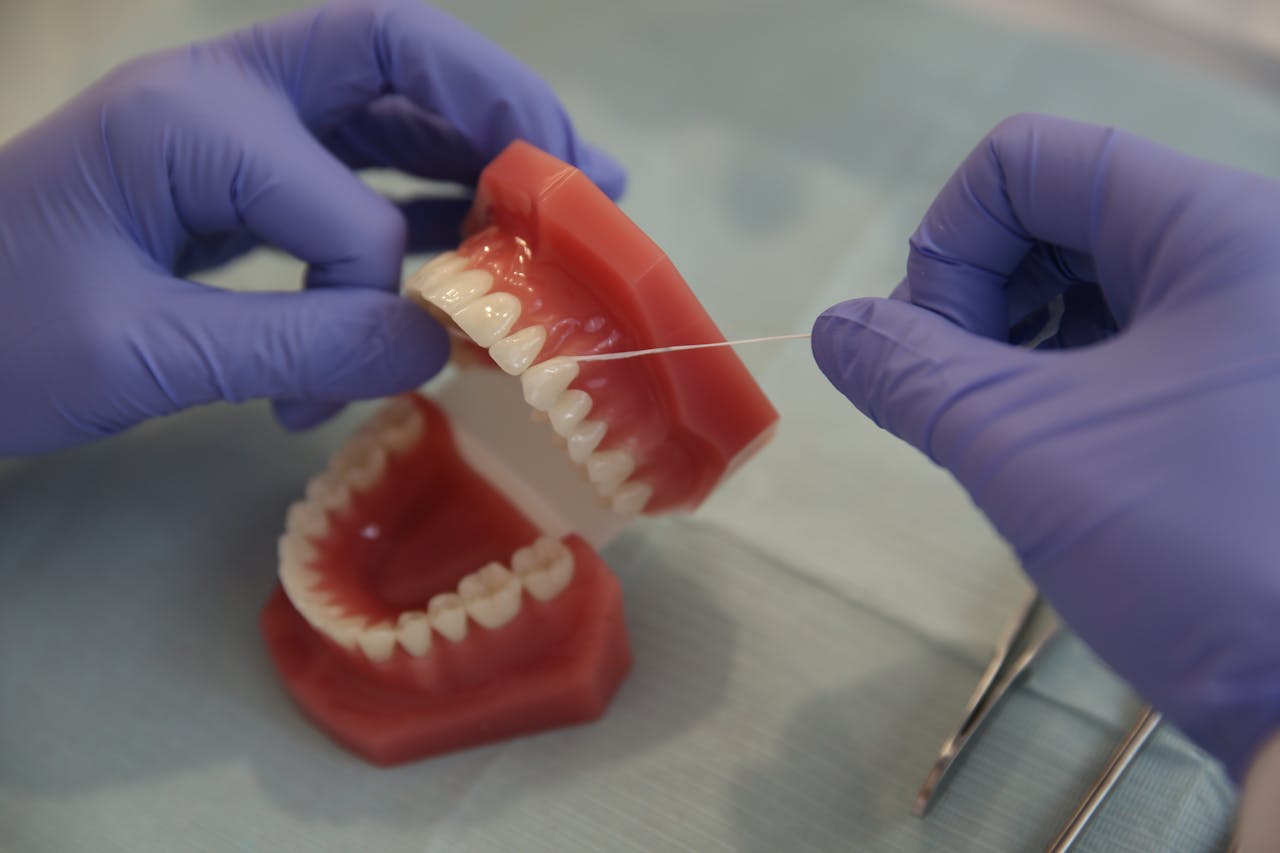 Overdentures Explained: How They Work and Who Needs Them