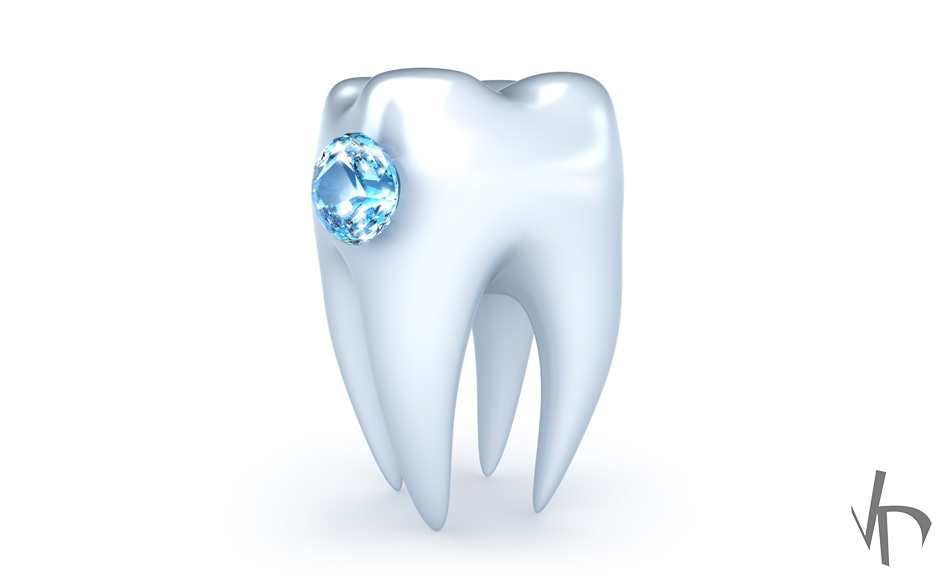 What Types of Tooth Jewelry Are There