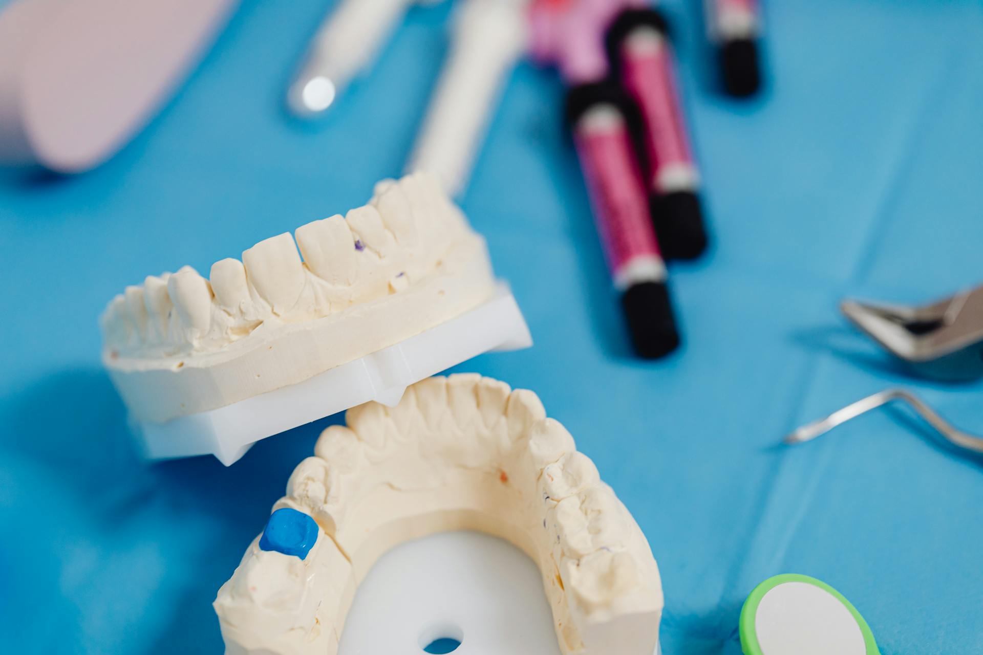 Self-Healing Dental Materials: Are They Possible?