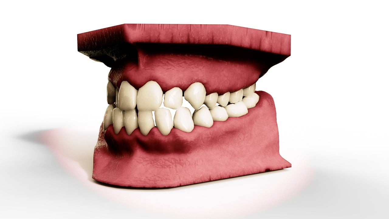Osteomyelitis of the Jaw: Symptoms and Treatment