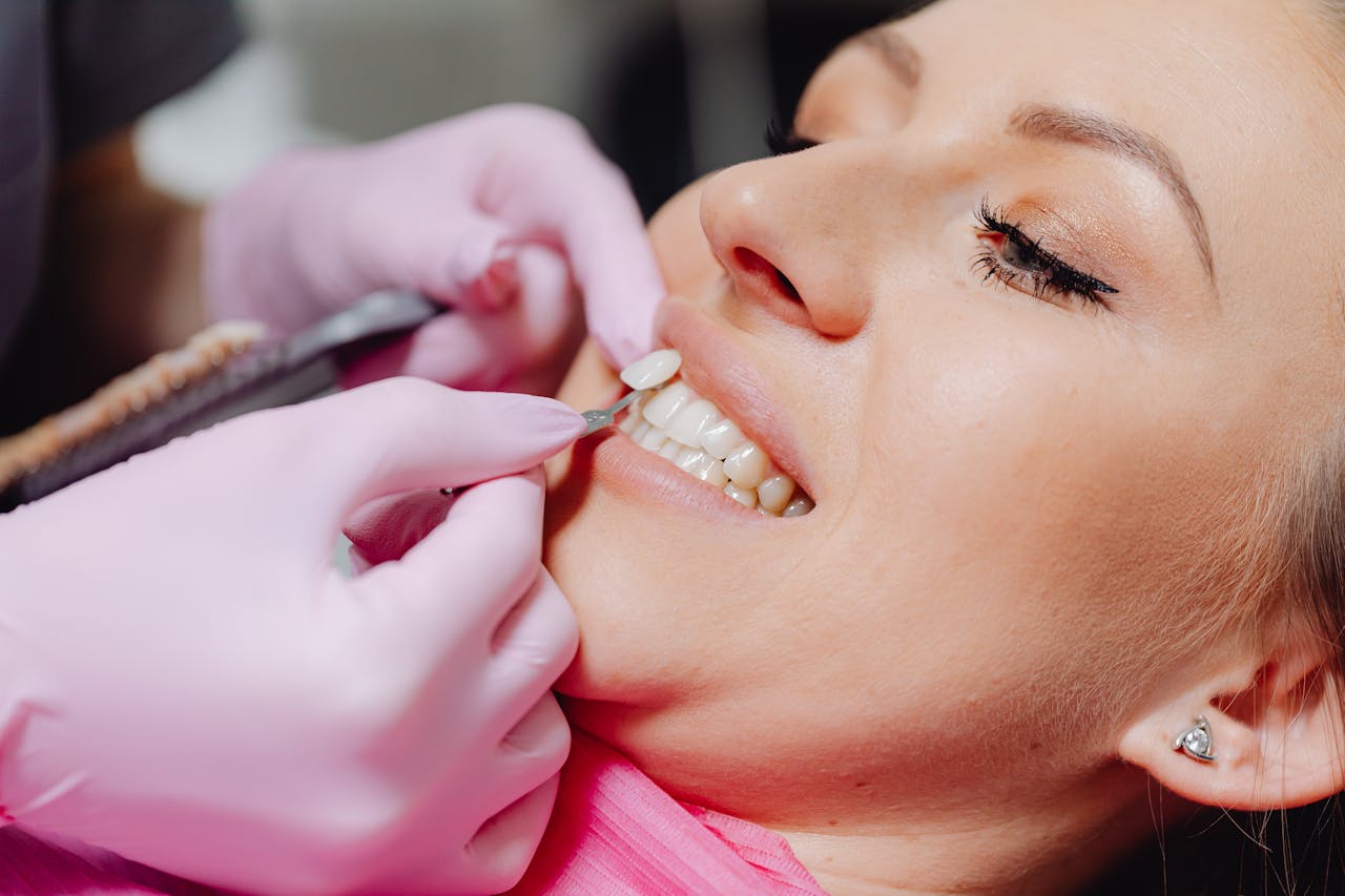 Teeth Under Veneers: Proper Care and Everything You Need to Know